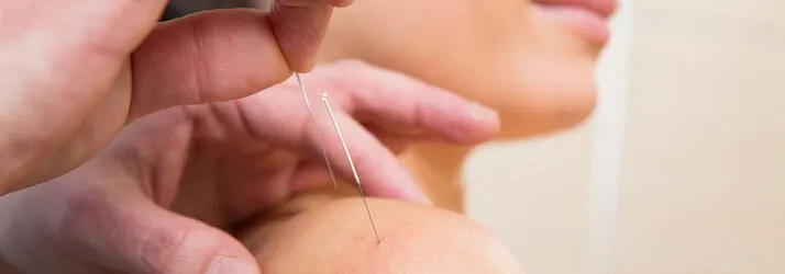 Chiropractic Rogers AR Dry Needling