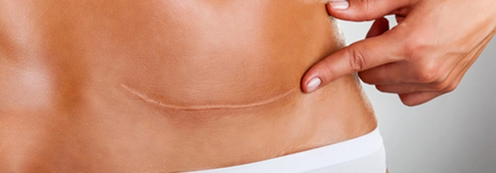 Chiropractic Rogers AR Scar Chiropractic Rogers AR Scar